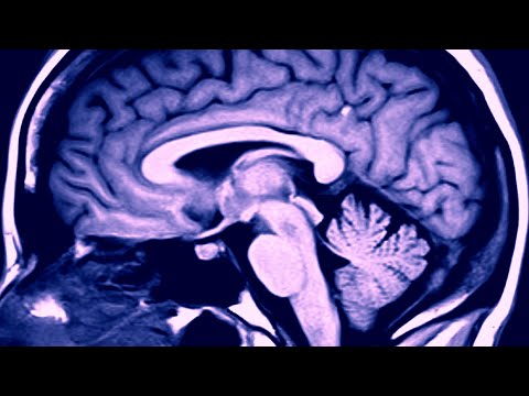 Ketamine &amp; Depression: How it Works - Yale Medicine Explains