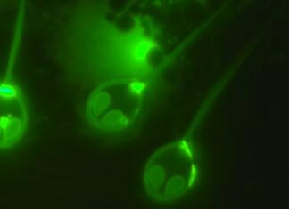 Odkrito prvo živo bitje, ki ne potrebuje kisika za življenje parazit