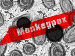 Črno-bele celice in rdeč napis Monkeypox