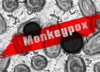 Opičje koze: širitev bolezni je bila pričakovana Črno-bele celice in rdeč napis Monkeypox