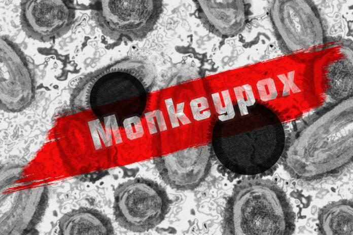 Črno-bele celice in rdeč napis Monkeypox