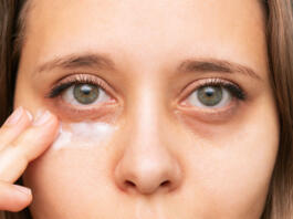 Cropped shot of a young caucasian woman touching a skin of her face while applying the cream for black eyes. Bruises under the eyes are caused by fatigue, nervousness, lack of sleep, insomnia, stress