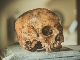 skull, head, bone
