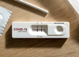 Nujne zobozdravstvene vstopne točke v času epidemije novega koronavirusa close up positive show result of covid infected show on nasal rapid self test kit at home