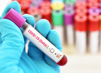 Imunost na koronavirus ne traja dolgo Delta variant COVID-19 positive, blood sample tube positive with delta variant or Indian strain COVID-19