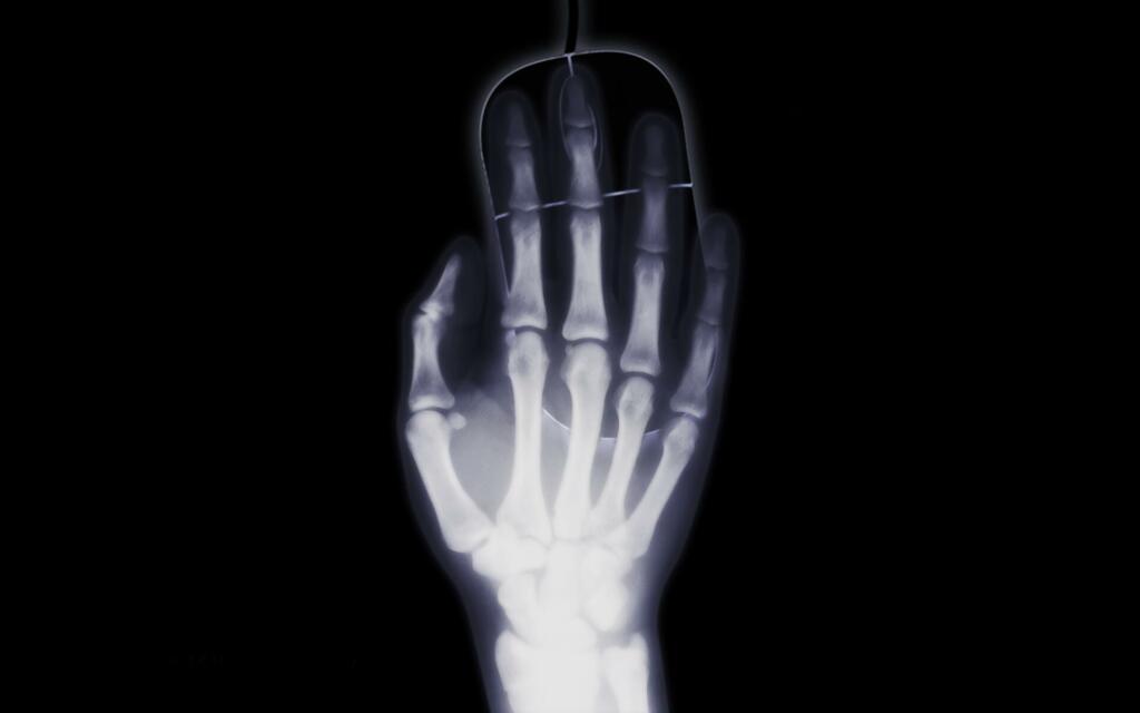 hand, roentgen, x-ray image