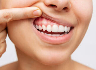Poskrbite tudi za zdravje zob Gum health. Cropped shot of a young woman showing healthy gums isolated on a white background. Dentistry, dental care