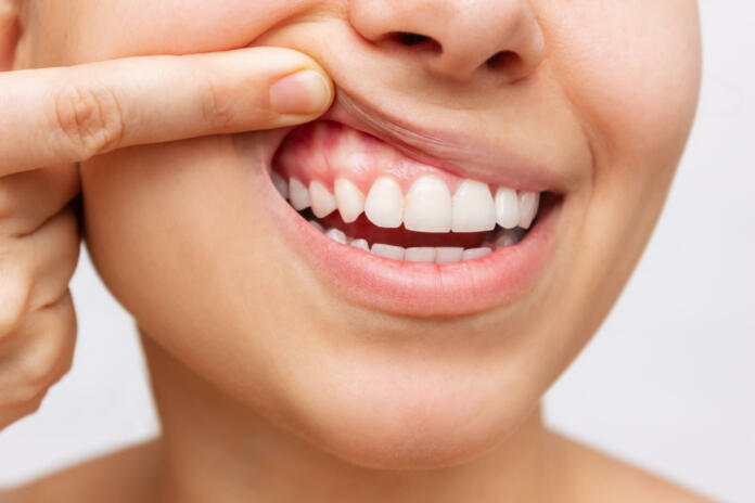 Gum health. Cropped shot of a young woman showing healthy gums isolated on a white background. Dentistry, dental care