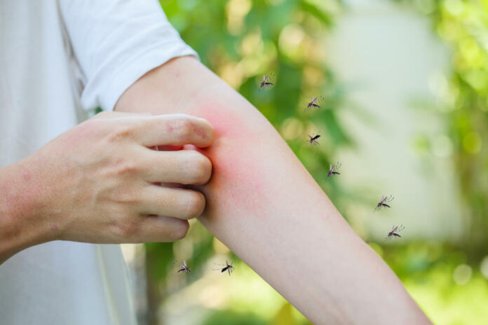 Man itching and scratching on arm from allergy skin rash cause by Mosquitoes bite