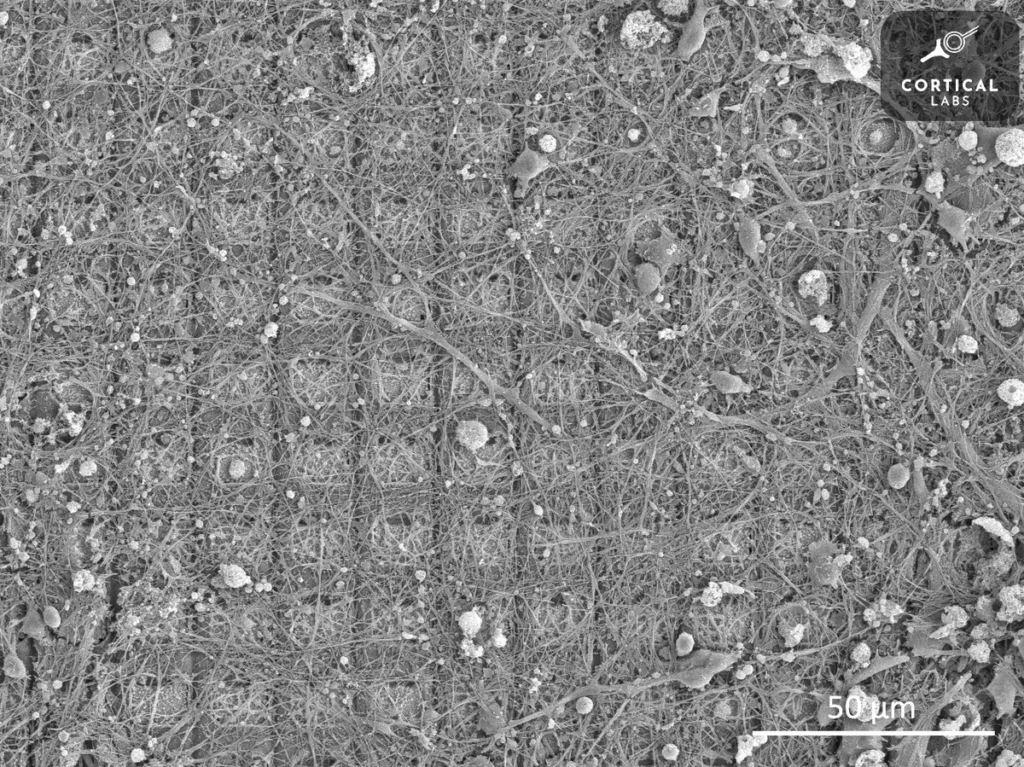 nevroni pod mikroskopom
