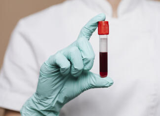 Utrujenost, slabo počutje, motnje koncentracije … je vzrok pomanjkanje železa? Anemija je najpogostejša oblika prehranske pomanjkljivosti na svetu.