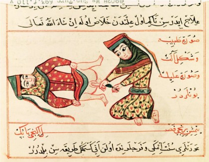 Prikaz operacije interspolne osebe iz leta 1466