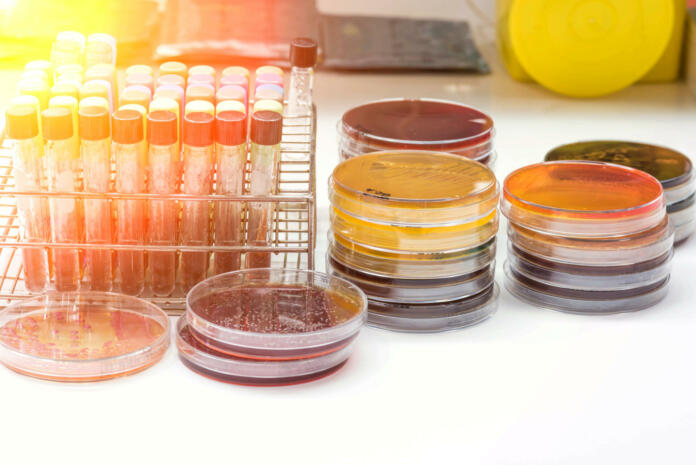 Biochem test kit for identified pathogen in microbiology room.