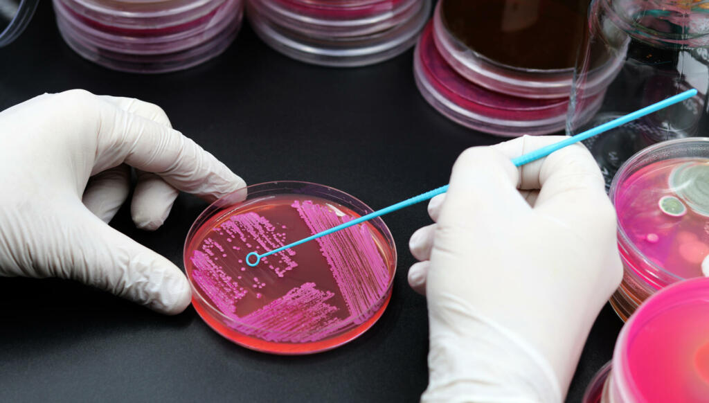 Handling of microorganisms in the laboratory, Blue microbiological inoculation loop