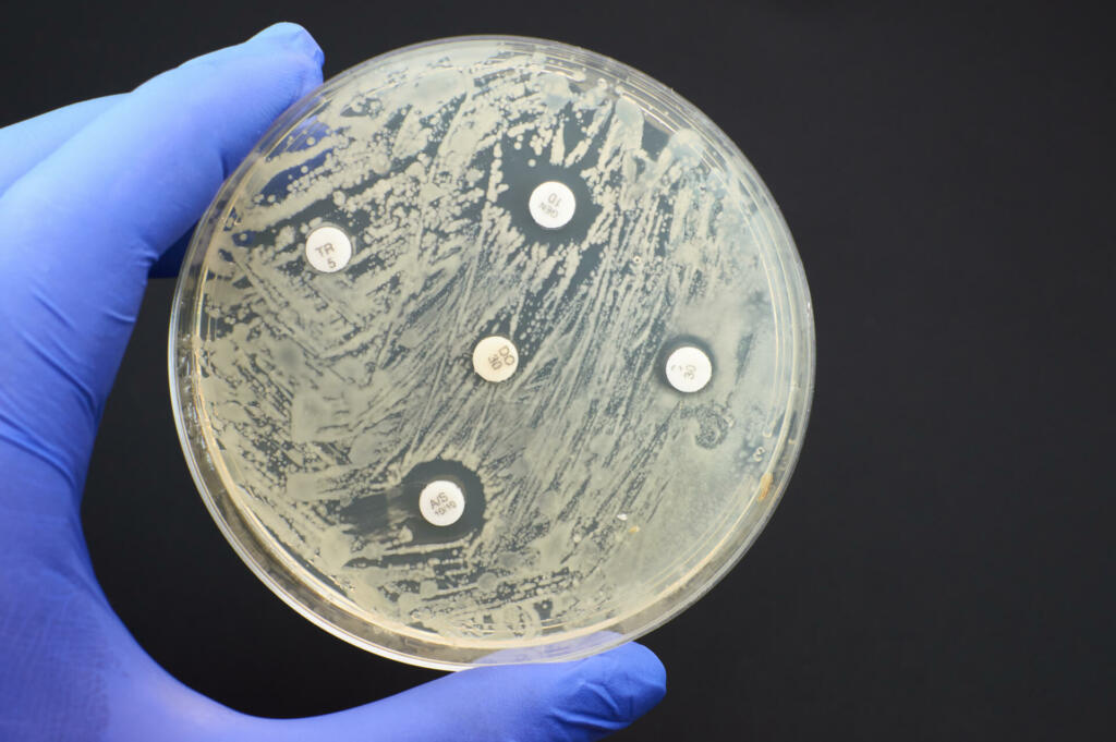 Antibiotic Sensitivity Test. Methods in Detecting Antimicrobial Resistance using petri dish. multidrug resistance