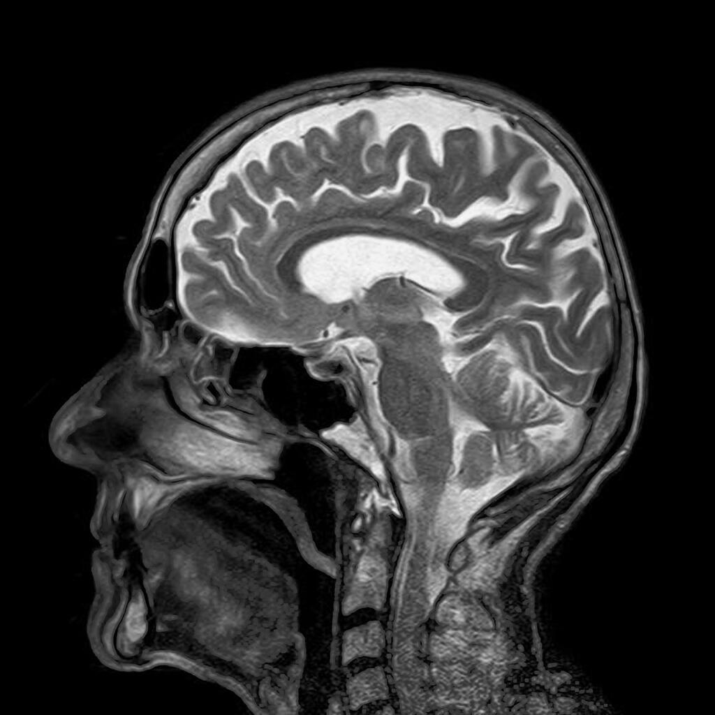 mri, magnetic resonance, roentgen