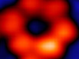 Prva rentgenska slika atoma