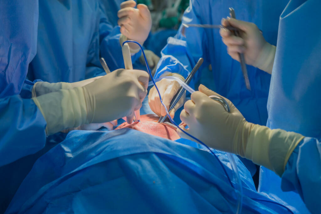 Doctors team wear blue coat perform heart surgery at the operating room in the hospital.