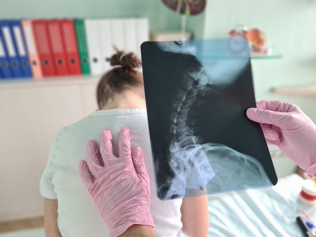 Pediatrician doctor examines x-ray of child spinal deformity concept