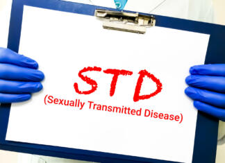 Vse, kar moraš vedeti o spolno prenosljivih boleznih STD (Sexually Transmitted Diseases) term with medical equipment's. HIV, HBV, HCV, Syphilis STD ,STOP STD. Medical and healthcare concept.
