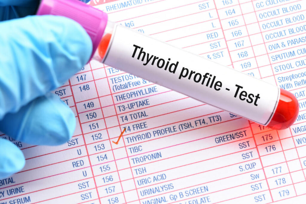 Blood sample for thyroid profile test