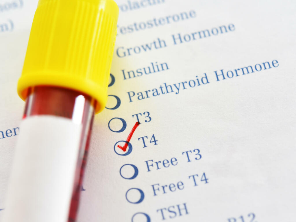 Blood sample tube with laboratory requisition form for thyroxine (T4) test