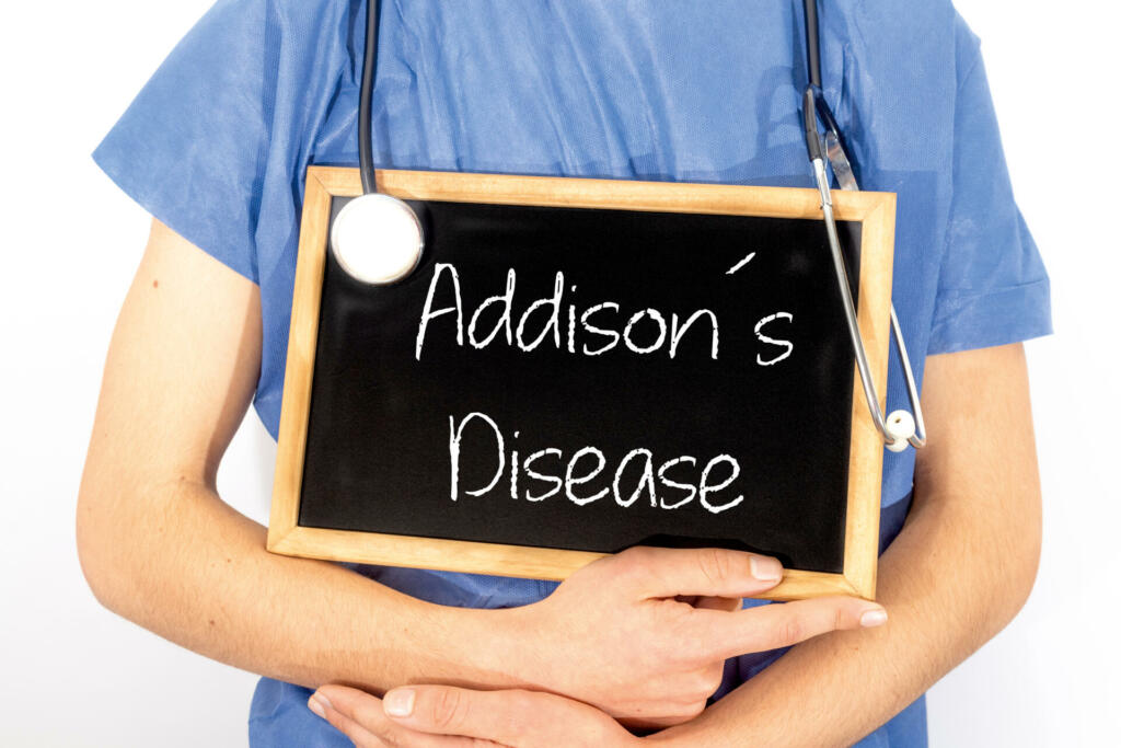 Doctor shows information on blackboard: addisonÂ´s disease. Medical concept.