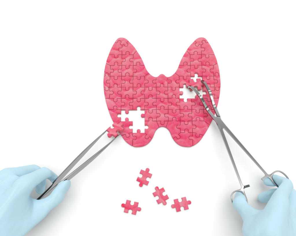 Thyroid puzzle concept: hands of surgeon with surgical instruments (tools) performs thyroid surgery as a result of hypothyroidism, thyroid adenoma, thyroadenitis, euthyroid goiter, iodine deficiency