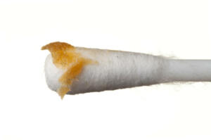 Yellow ear wax on a swab isolated over white