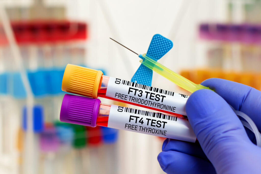 doctor holding Blood tube for analysis of Free triiodothyronine FT3 and Free Thyroxine FT4 hormones. Blood sample for study of FT3 Free triiodothyronine and FT4 Free Thyroxine for Thyroid exam
