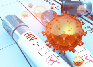 Aids – bolezen, ki še danes ostaja medicinska uganka HIV test positive, hiv virus. 3d illustration