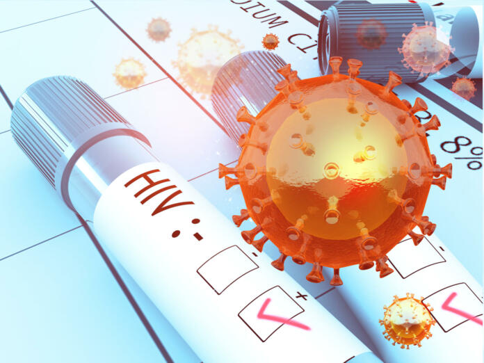 HIV test positive, hiv virus. 3d illustration