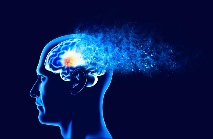 Memory lapses, forgetting things, degenerative disease. Brain problems. Parkinson and alzheimer desease. Mental health. Stroke, synapses and neurnons interaction. Face side view. 3d rendering