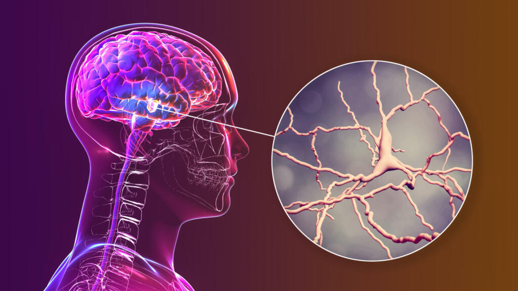 Black substance of the midbrain and its dopaminergic neurons, 3D illustration. Black substance regulates movement and reward, its degeneration is a key step in development of Parkinson's disease