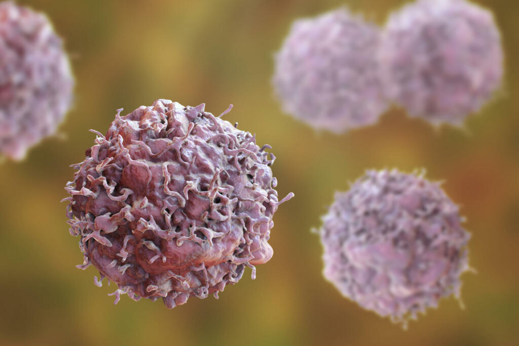 Cancer cells, malignant cells, scientific 3D illustration