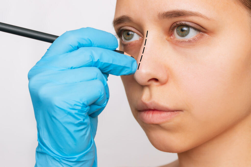 Rhinoplasty. Cropped shot of a young caucasian woman with marking on her nose on a white background. The doctor's gloved hand makes marks on the patient's face. Facial plastic surgery concept