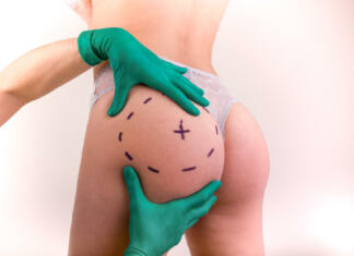 Najbolj priljubljeni lepotni posegi Najbolj priljubljeni lepotni posegi