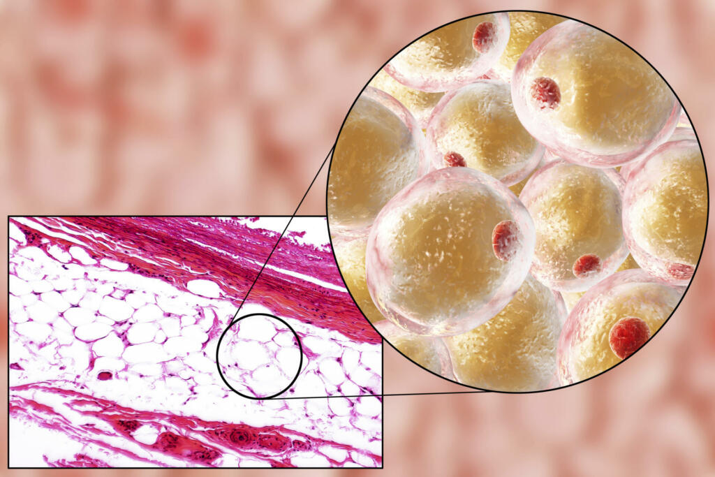 White adipose tissue, light micrograph and 3D illustration, hematoxilin and eosin staining, magnification 100x. Fat cells (adipocytes) have large lipid droplet which remains unstained