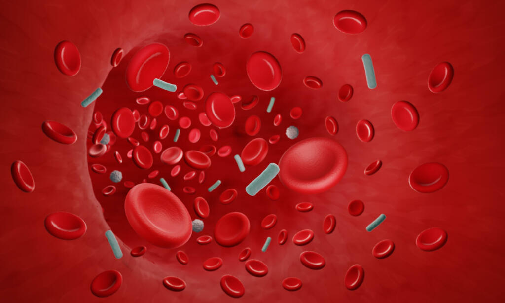 3d illustration showing infected blood in blood vessel