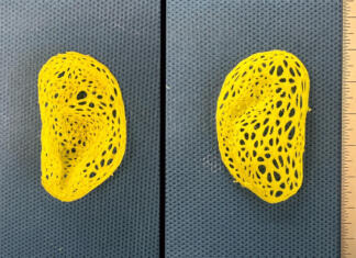 Znanstvenikom uspel neverjeten uspeh! Naredili repliko človeškega ušesa Plastično ogrodje replike človeškega ušesa, ki so ga naredili znanstveniki