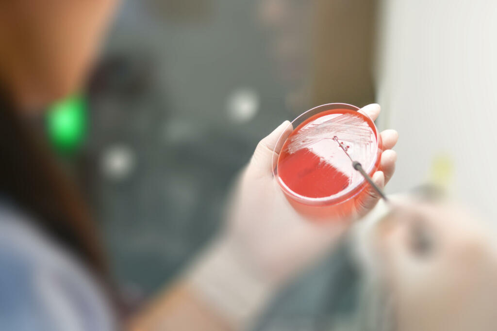 Lab technicians working on the media plate to culture and bacteria and drug resistance of pathogens in hospital laboratory; Medical laboratory healthcare concept.