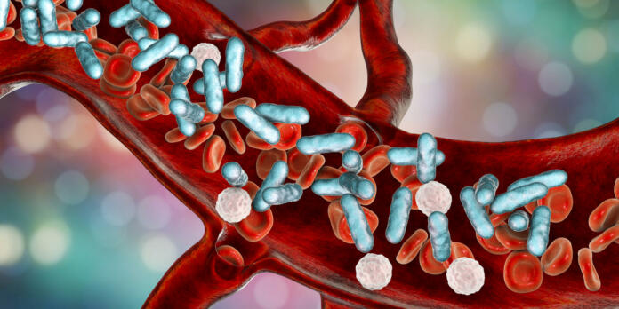 Sepsis, bacteria in blood. 3D illustration showing rod-shaped bacteria with red blood cells and leukocytes