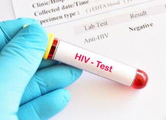 Ustvarjen napredek pri cepivu proti HIV Napredek pri cepivu proti HIV