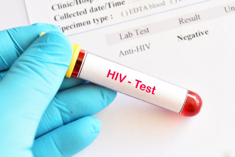 Ustvarjen napredek pri cepivu proti HIV