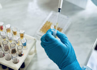 Podjetje razvilo encime, ki bi lahko rešili globalni problem Ссылка ×Название:
Filling 96 well plate for microbiological analysis by pipette. DNA or ELISA test