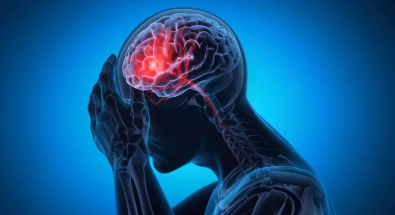 Man with a headache -  Brain Stroke -  X ray 3D Illustration with blue background