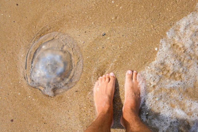 Kaj storiti ob ožigu meduze in morskega ježka?