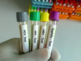 Scientist hold blood samples tube for Sexuallly Transmitted Disease. Syphilis,  HBV, HIV, HCV