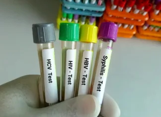Spolno prenosljive okužbe so v porastu – zakaj in zato Scientist hold blood samples tube for Sexuallly Transmitted Disease. Syphilis, HBV, HIV, HCV