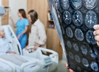 Kratica GROM, ki lahko reši življenje: Danes je svetovni dan možganske kapi MRI of head of elderly woman in hands of doctor standing in medical ward near senior patient with relative and nurse. Recovery after a stroke